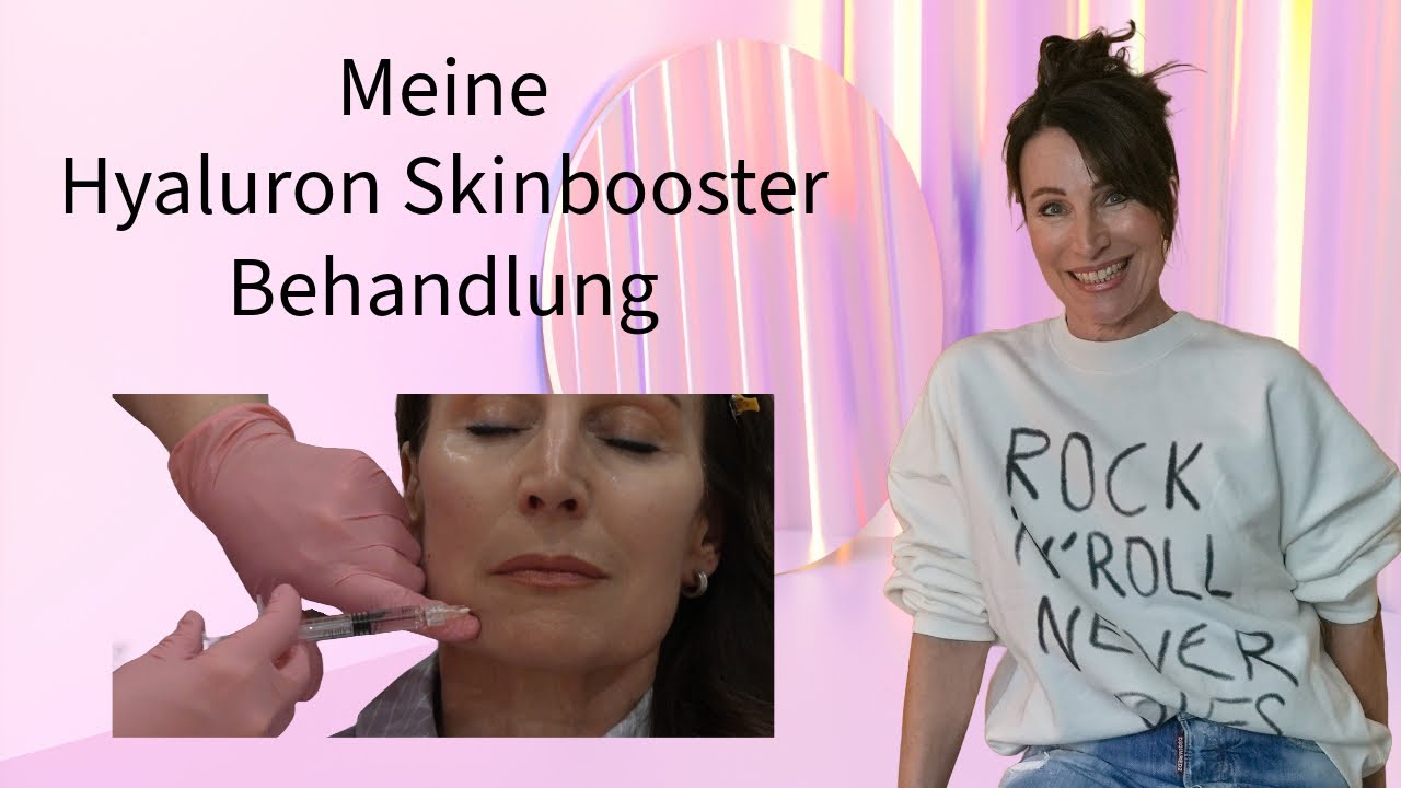 HYALURON SKINBOOSTER BEHANDLUNG  💟 EINBLICKE & ERFAHRUNG