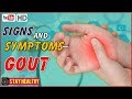 10 Signs and Symptoms of Gout