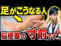 【突然倒れます…】知らないと後悔する『脳梗塞』の”足”の危険サイン５選【超意外な初期症状を医師解説】
