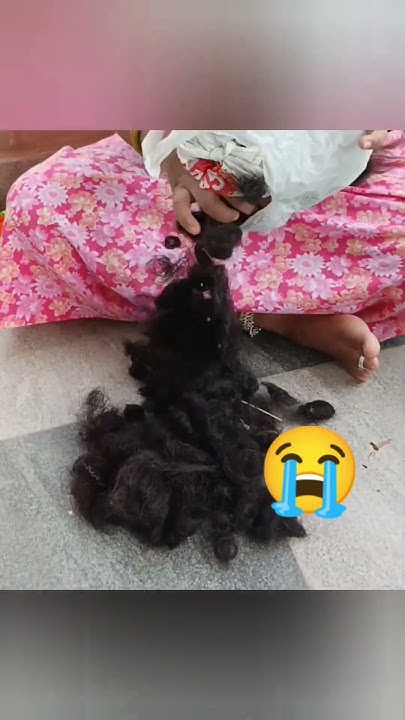 after-delivery-hair-fall