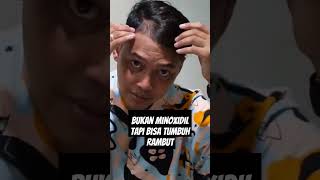 Download Lagu Bukan Minoxidil Tetapi Bisa Menumbuhkan Rambut Botak #penumbuhrambut #rambutbotak #minoxidil MP3 Download Lagu Bukan Minoxidil Tetapi Bisa Menumbuhkan Rambut Botak #penumbuhrambut #rambutbotak #minoxidil MP3