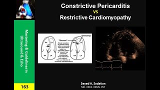Constrictive Pericarditis vs Restrictive Cardiomyopathy