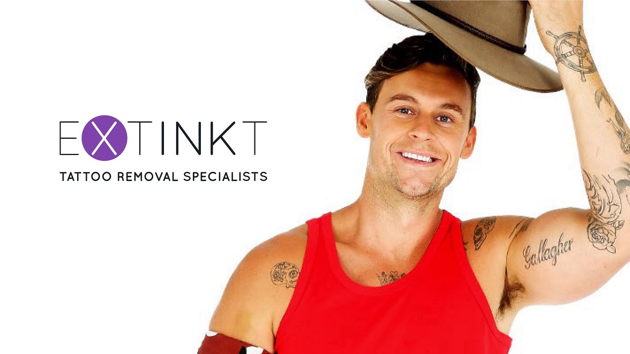 Best Tattoo Removal Hospital in Delhi  Primus Super Speciality Hospital