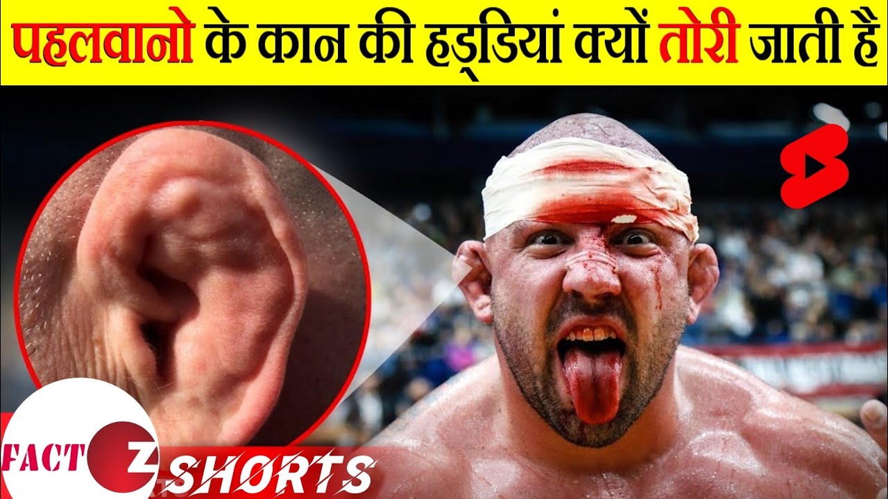 Why wrestlers ear is deformed? shorts YouTube