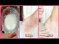 Natural Way To Remove Unwanted Armpit Hair Permanently