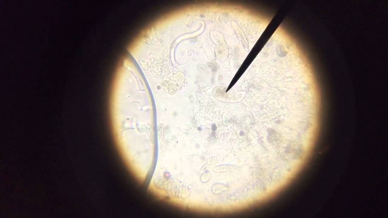 Suspected brown jelly disease YouTube