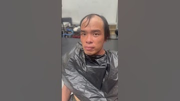 Kiểu tóc quốc dân của người hói đầu, cách để người hói đẹp hơn #reviewxămtóc #lamdep #xămchântóc