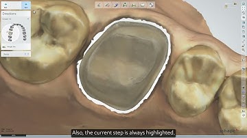 Understanding the tools and features available in Dental Designer