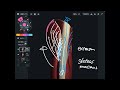 Anatomy of thigh fascia and causes of tightness