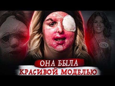 Из будущей звезды — в инвалида...
