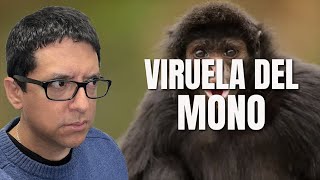 Lo Que Sabemos de la Viruela del Mono