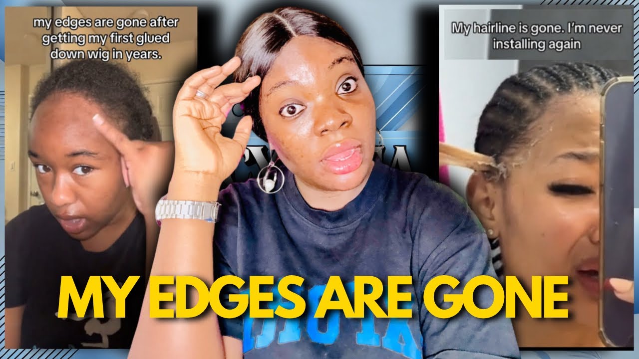 Are Wigs Secretly Destroying Women’s Hairlines in 2026?