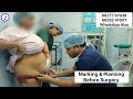 Liposuction In Guwahati | Cost Of Liposuction Surgery in Guwahati | Zenith Clinic