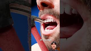 Fixing A Chipped Tooth 🦷 🤓 #historicalmyths #history #dentist #usashorts #viralshorts