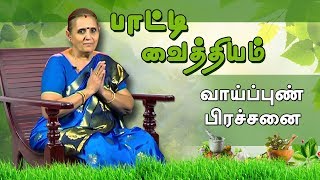 Download lagu வாய்ப்புண் பிரச்சனை | பாட்டி வைத்தியம்
