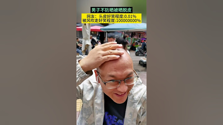 男子不防晒被晒脱皮  网友：头皮好笑程度:0.01% 被风吹走好笑程度:100000000% #搞笑 #看一遍笑一遍 #夏天