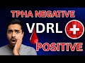 VDRL TPHA Positive Treatment in Urdu | VDRL Test Kya Hota Hai | VDRL Negative Kaise Hota Hai