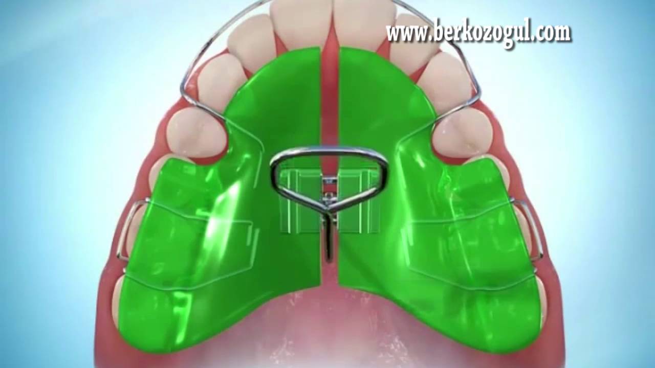 Fonksiyonel Tedavi Nedir? Kimlere Uygulanır?