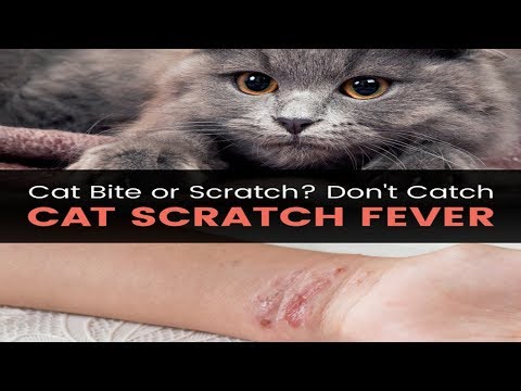 6 Natural Ways to Treat Cat Scratch Fever Symptoms - How to Prevent Cat Scratch Fever