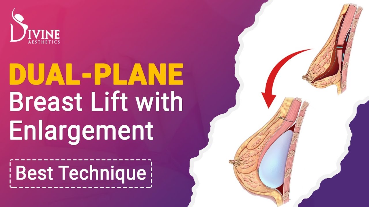 DualPlane Breast Lift with Enlargement Best Technique Dr Amit Gupta Best Plastic Surgeon