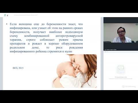 Бейне: CICS-те СПИД аббревиатурасы нені білдіреді?