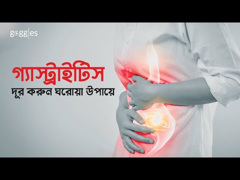 গ্যাস্ট্রাইটিস দূর করুন ঘরোয়া উপায়ে | Gastritis Problem | ACIDITY  | Goggles