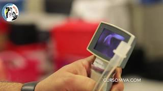 Intubación con Videolaringoscopios