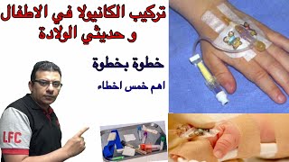 تركيب الكانيولات للاطفال. خطوة بخطوة. how to insert an iv cannula (Eng translated).