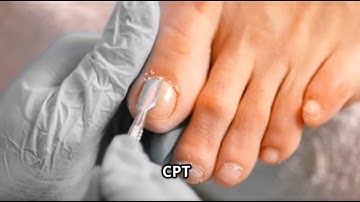 Overview on Mastering Podiatry Coding