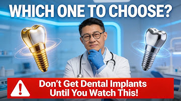 Best Dental Implants 2025  Which Brand to Choose? Straumann vs Nobel vs Cheap Alternatives