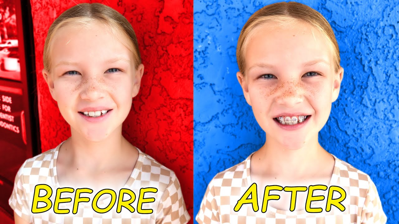 Madison Gets Braces!!! BEFORE and AFTER! YouTube