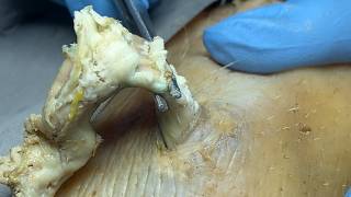 𝑹𝒆𝒍𝒂𝒙𝒊𝒏𝒈 𝑭𝒂𝒄𝒊𝒂𝒍 𝑪𝒍𝒆𝒂𝒏𝒔𝒊𝒏𝒈: 𝑴𝒊𝒄𝒆𝒍𝒍𝒂𝒓 𝑾𝒂𝒕𝒆𝒓 𝒗𝒔 𝑪𝒍𝒆𝒂𝒏𝒔𝒊𝒏𝒈 𝑶𝒊𝒍 1455