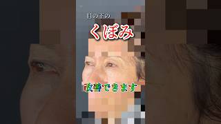 目の下ヒアルロン酸で垢抜け❤️ #shorts #下川洋輝 #美容 #整形垢