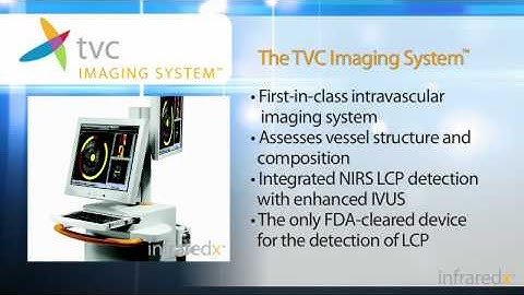 Introduction to the TVC Imaging System