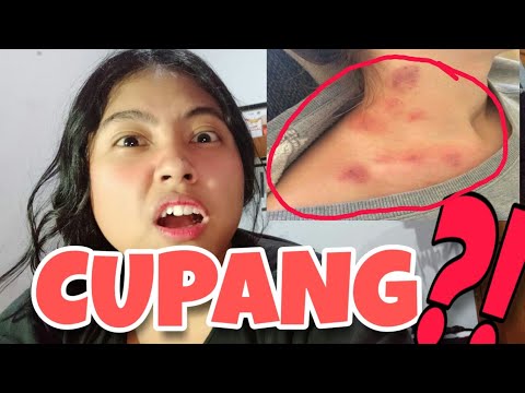 CARA ALAMI MENGHILANGKAN BEKAS CIUMAN (CUPANG) ||DESY CAHYANI LARI