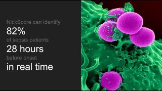 NickScore: A Model for Sepsis Prediction