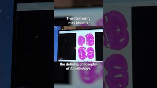 Trust but verify may become the defining philosophy of AI pathology