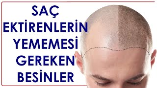 Saç Ekti̇rdi̇yseni̇z Sakin Bunlari Yemeyi̇n