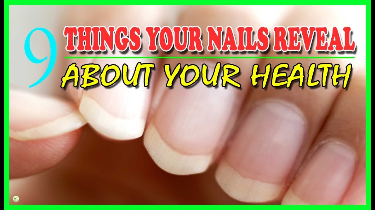 9 Things Your Nails Reveal About Your Health Best Home Remedies YouTube