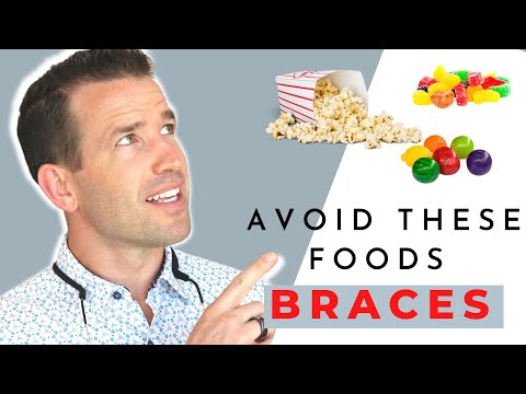 Avoid These Foods With Braces Shorts