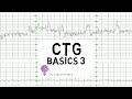 Ctg basics part 3  overall assessment  examples