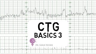 CTG Basics Part 3 - Overall Assessment & Examples