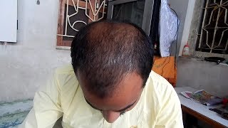 Hair fall | Hair Nutriment | Nourishing Shampoo | Netsurf | Amreli - YouTube