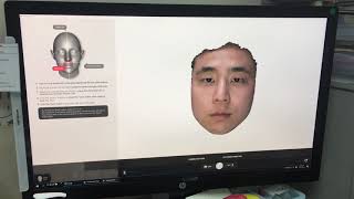 Preoperative simulation using Morpheus 3D scanner