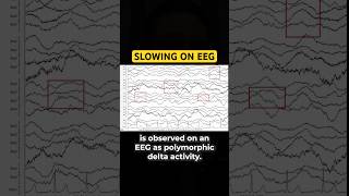 What Does An Look Like In A Patient With Cgs?