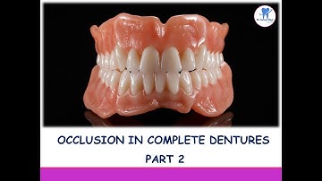Occlusion in complete dentures Part 2/ Occlusion/ Prosthodontics/ Dr Aaryas Vlogs Dentistry