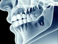 Рентген зубов в стоматологии