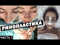 Ринопластика | Моя история | Сдача анализов | Консультация с хирургом| ВИДЕО С ОПЕРАЦИОННОЙ. Часть 1