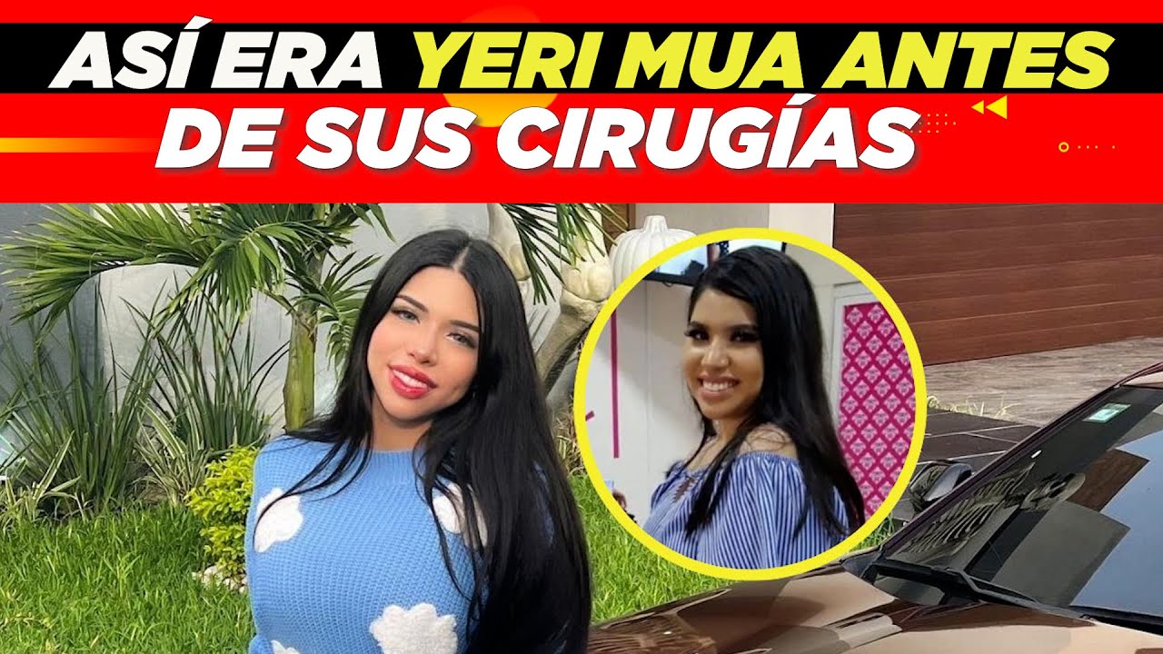 Así era Yeri Mua antes de sus cirugías 🫣 - YouTube