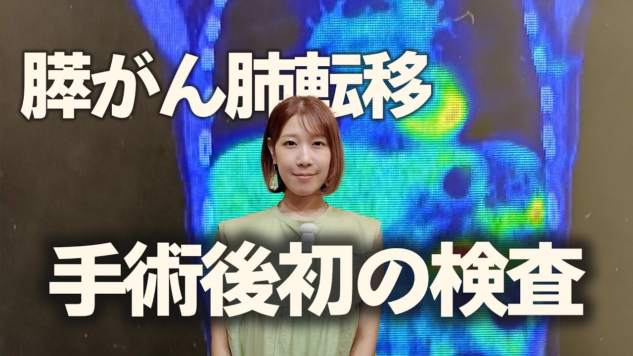 今後の治療を左右するPET検査の結果【膵臓がんステージ4】